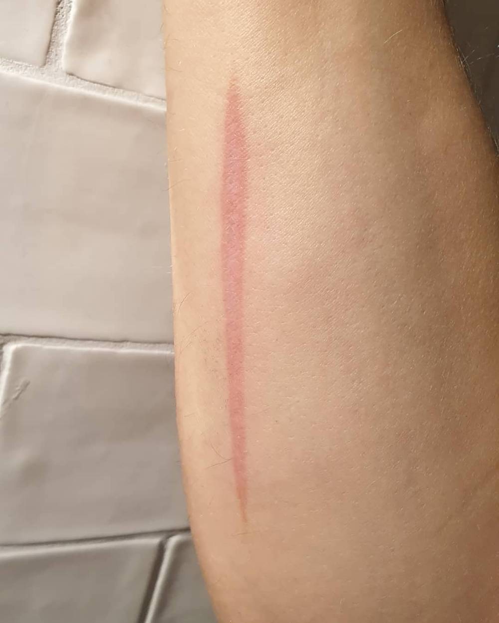 Close-up of a long red scratch mark on a forearm.