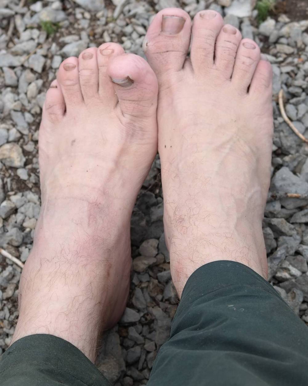 Gnarly feet